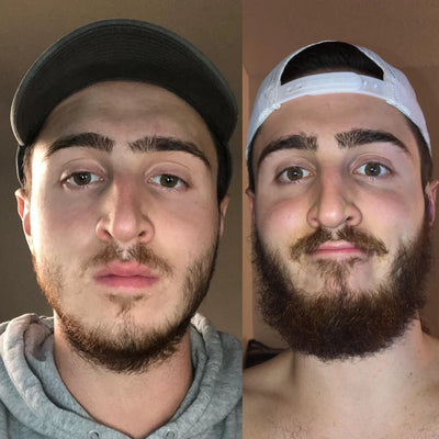 Résultat barbe de Yanis A.
