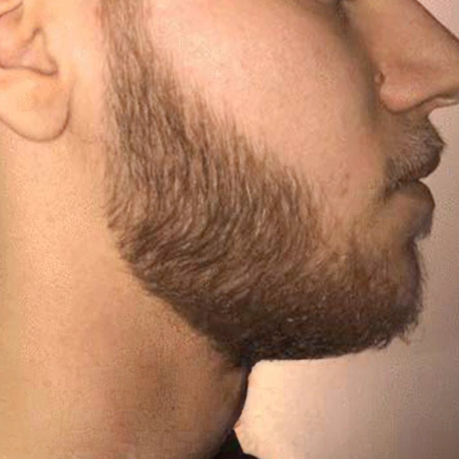 Après utilisation Boost Barber - barbe plus uniforme