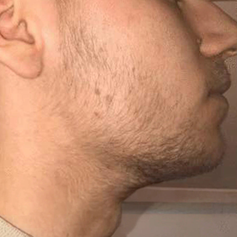 Avant utilisation Boost Barber