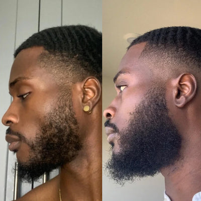Résultat barbe de Kevin M.